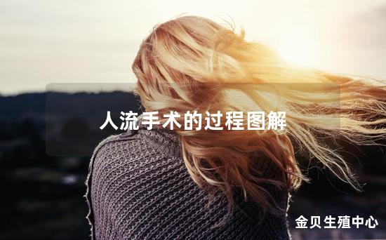 人流手术的过程图解