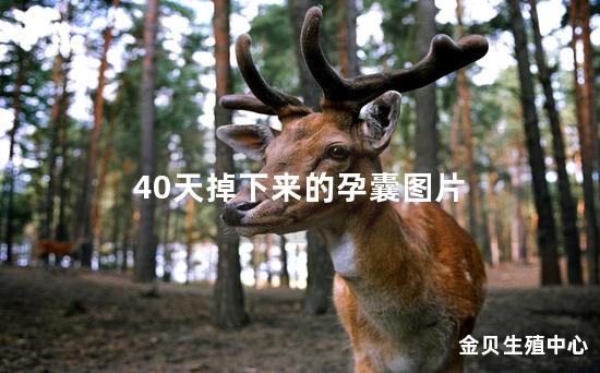 40天掉下来的孕囊图片