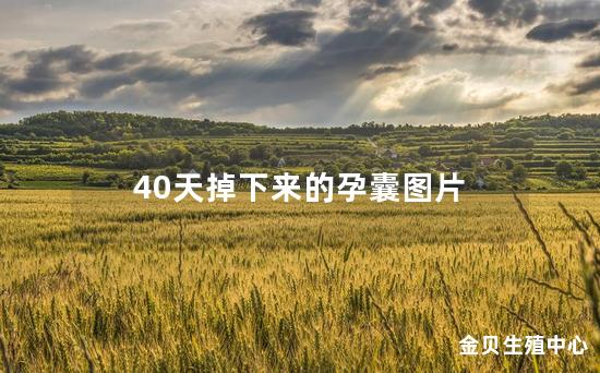 40天掉下来的孕囊图片