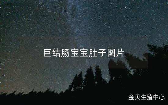 巨结肠宝宝肚子图片