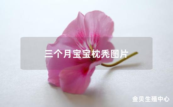 三个月宝宝枕秃图片