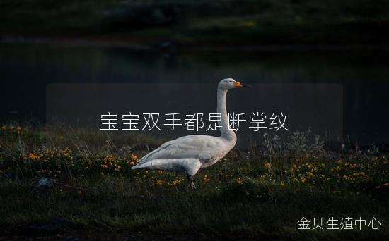 宝宝双手都是断掌纹