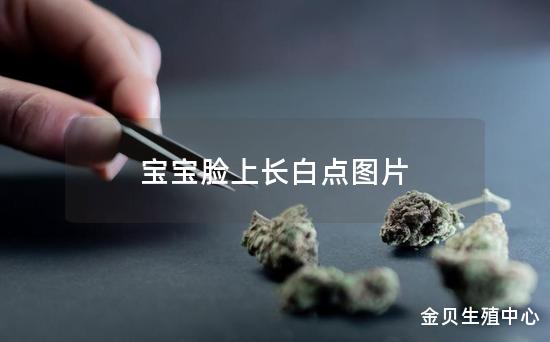 宝宝脸上长白点图片