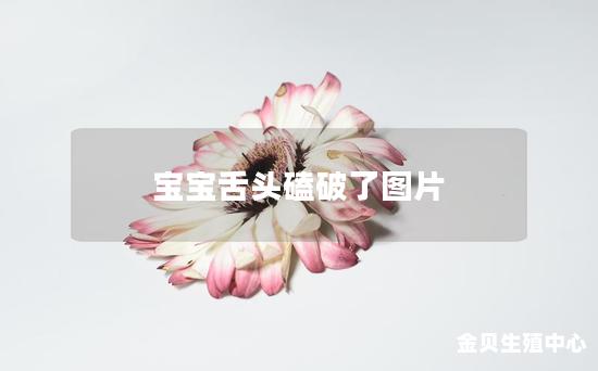 宝宝舌头磕破了图片